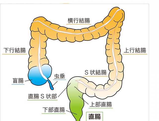 直腸がんと結腸直腸がんはどう違うのですか?